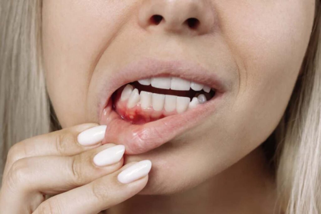 Questo sintomo può rappresentare un indicatore di condizioni cliniche serie, tra cui la leucemia.