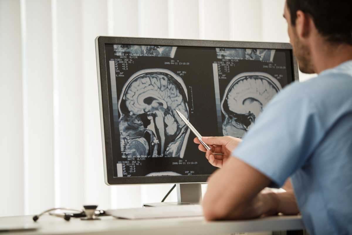 Tumore come prevenire sintomi confusi